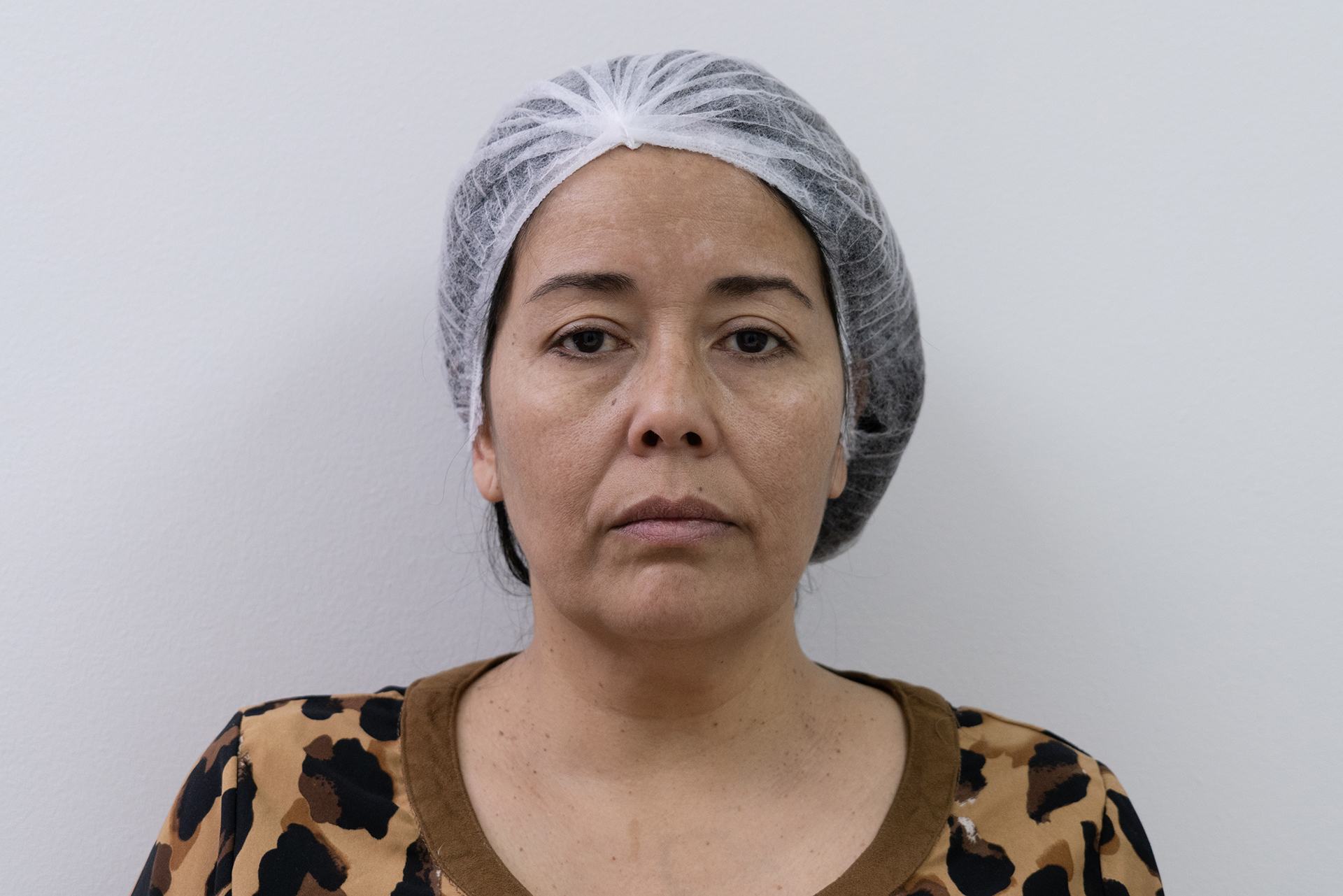 Antes del multi layers (tratamiento facial combinado) en Buddha Clinic