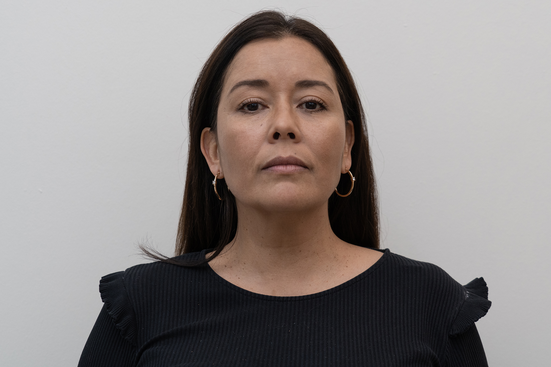Después del multi layers (tratamiento facial combinado) en Buddha Clinic